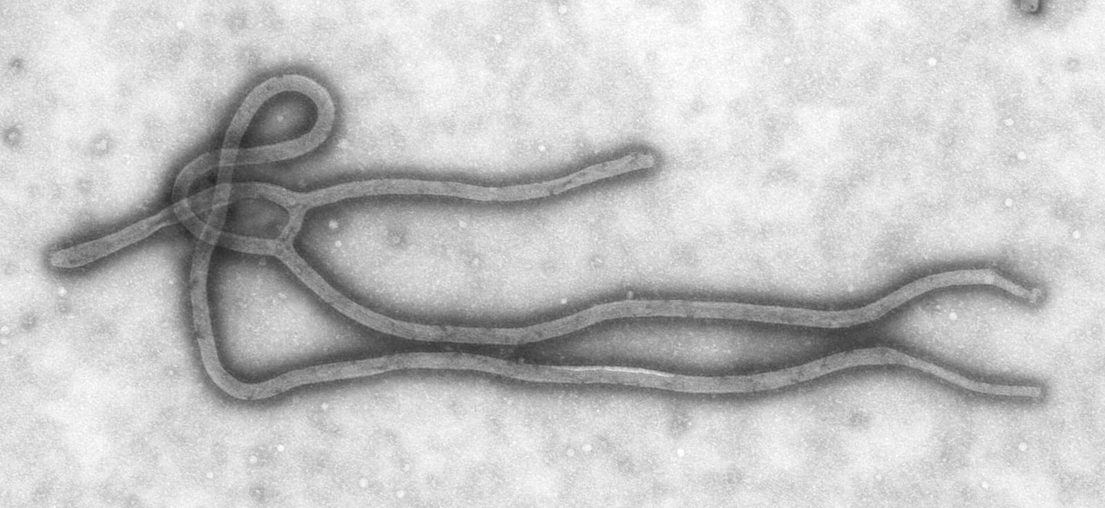 File photo: Electron micrograph showing the filamentous structure of an Ebola virus particle