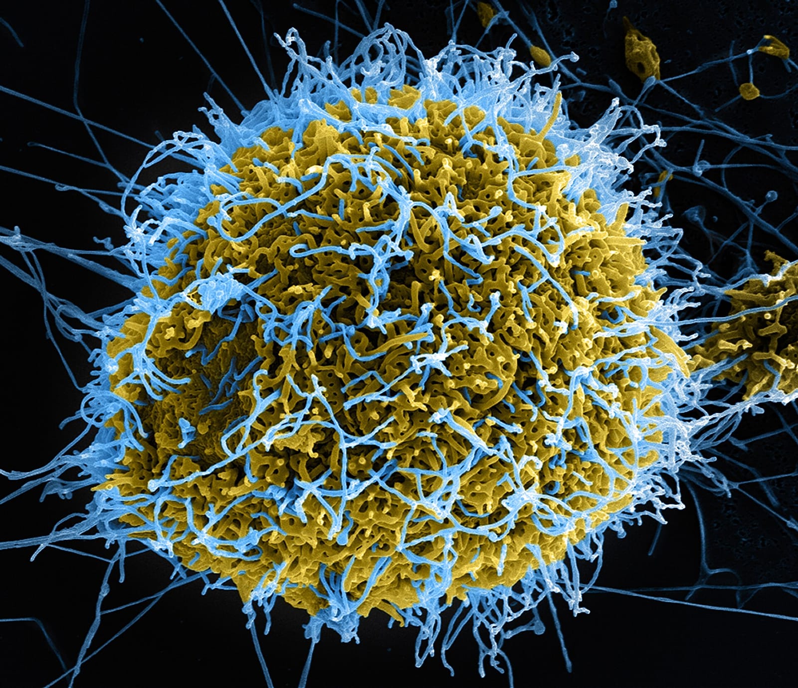 File photo: Colorized micrograph of Ebola virus particles budding from cell