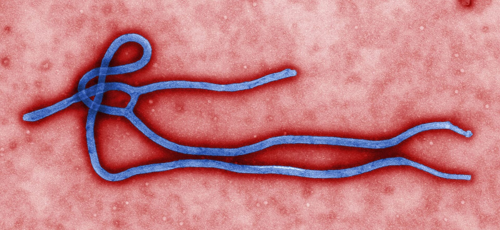 File photo: Colorized electron micrograph of an Ebola virus particle