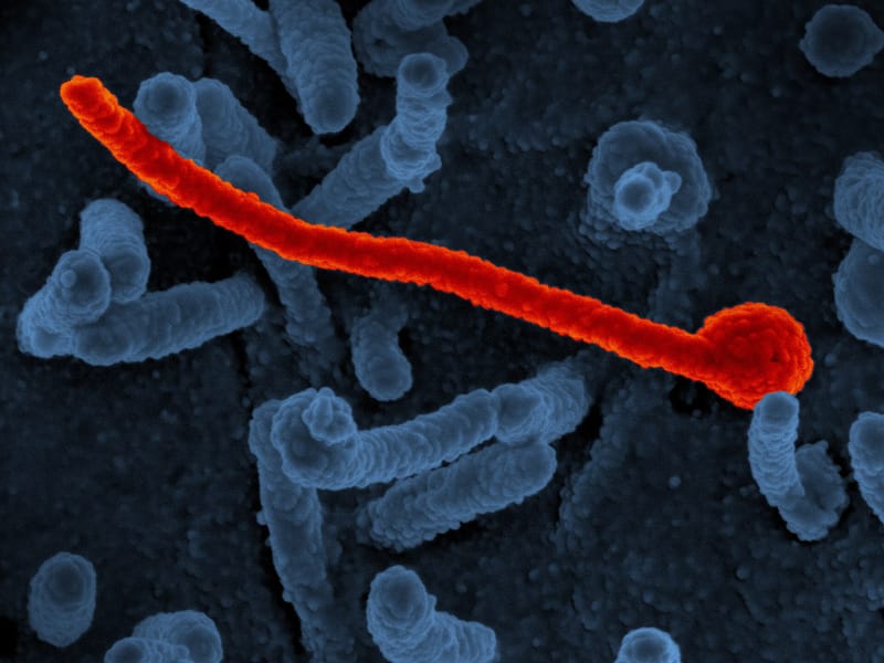 Ebola cases in DR Congo surpass 9,000, according to Reuters and Anadolu Agency